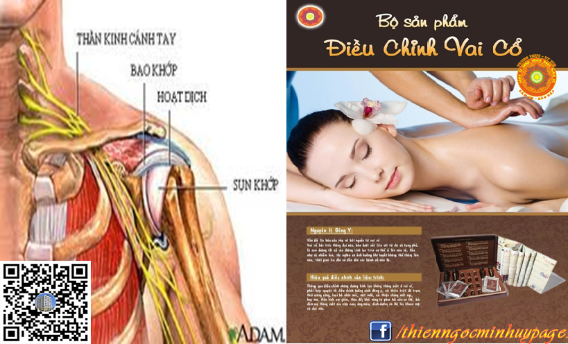 Hội chứng ĐAU VAI GÁY