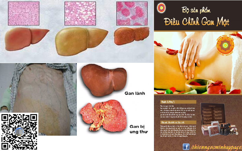 Gan và chức năng của gan